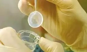 一眼萬年幾度輪回:華德眼科角膜移植全攻略