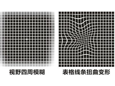 看東西變形了？莫讓眼底病偷走你的視野！