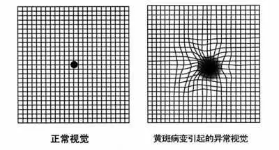 拯救五類“惡”視力，它們可能令你致盲！