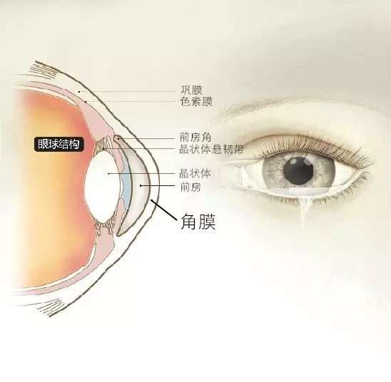 北京去哪治圓錐角膜好？！