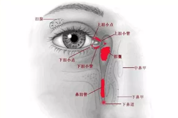 淚道阻塞的方法