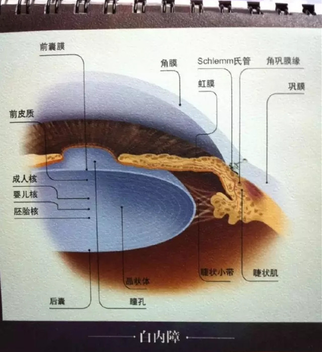 眼科醫(yī)生：白內(nèi)障早期癥狀和應(yīng)對方法