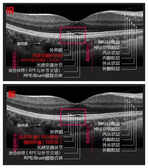 眼底OCT分層，一文教你全看懂！